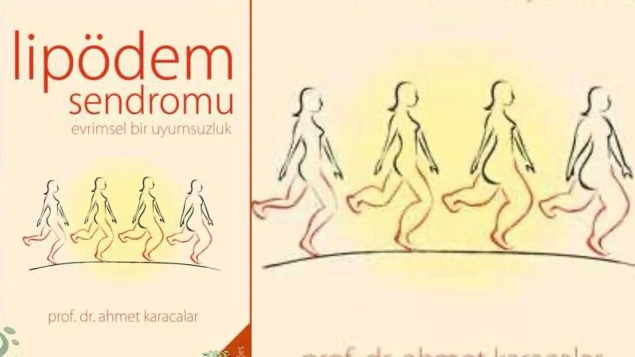 Lipödem Sendromu: Evrimsel Bir Uyumsuzluk